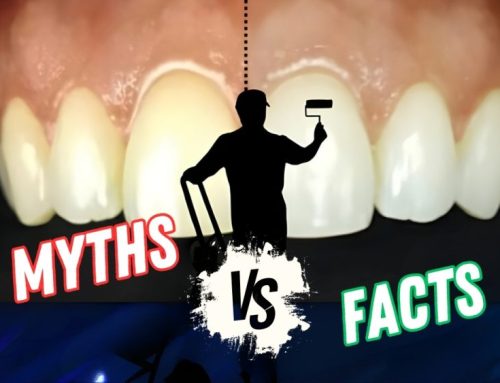 Natural teeth whitening: Facts VS. Myths