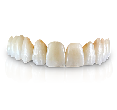 7332-Glacier-Thumbnail72