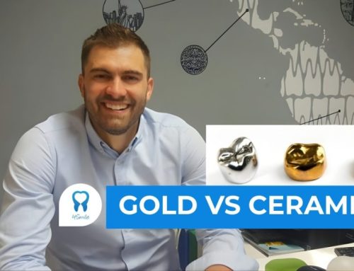 Gold dental crowns vs. ceramic dental crowns