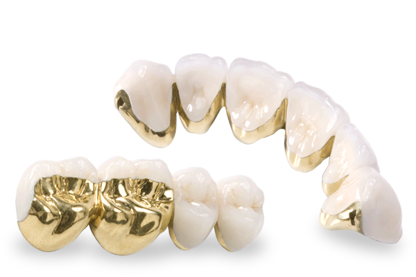 occlusal-gold72