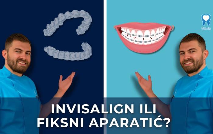 invisalign-ili-fiksni-aparatic-za-zube-kratki-video-blog