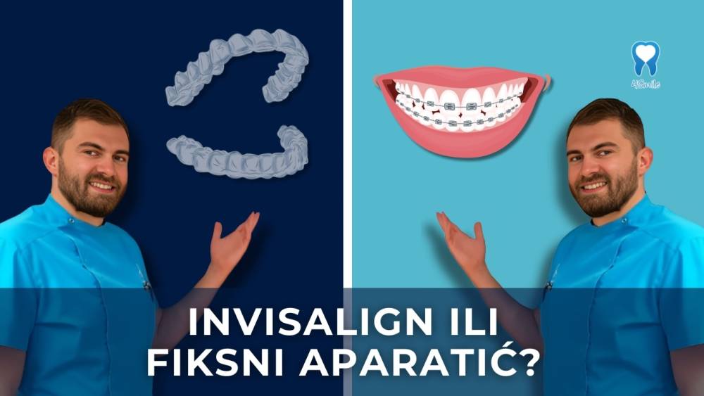 invisalign-ili-fiksni-aparatic-za-zube-kratki-video-blog invisalign-ili-fiksni-aparatic-za-zube-kratki-video-blog