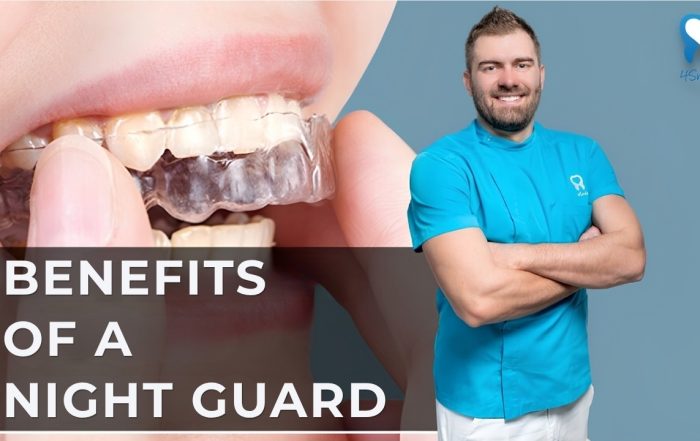 benefits-of-a-night-guard