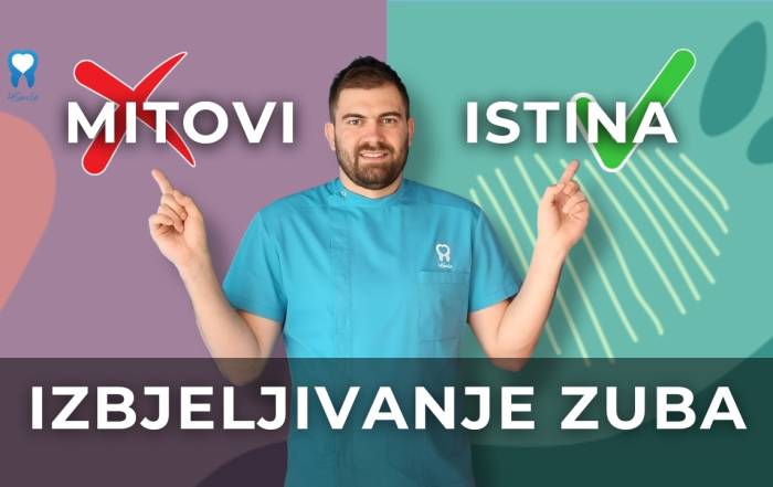 izbjeljivanje-zuba-mitovi-i-cinjenice