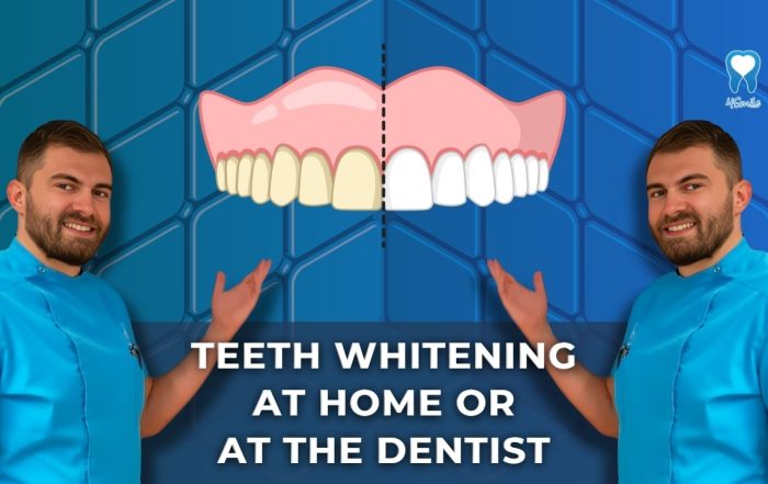 teeth-whitening-at-home-or-at-the-dentist