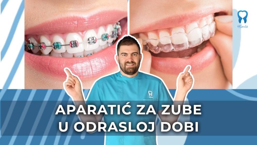 aparatic-za-zube-u-odrasloj-dobi-estetika-zdravlje-i-osmijeh-koji-traje aparatic-za-zube-u-odrasloj-dobi-estetika-zdravlje-i-osmijeh-koji-traje