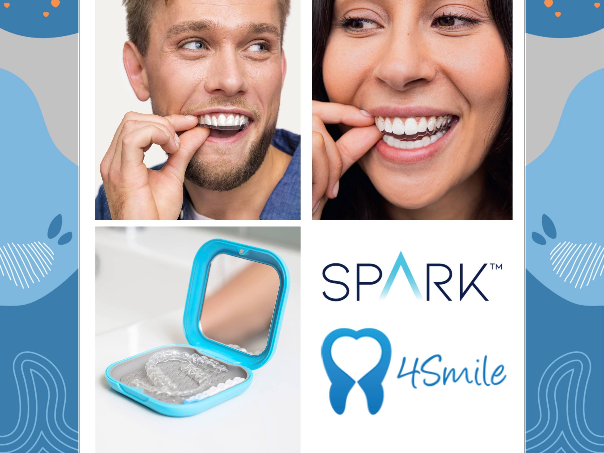 spark aparatić za zube
