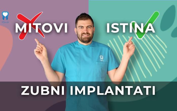 zubni-implantati-mitovi-i-cinjenice-koje-morate-znati